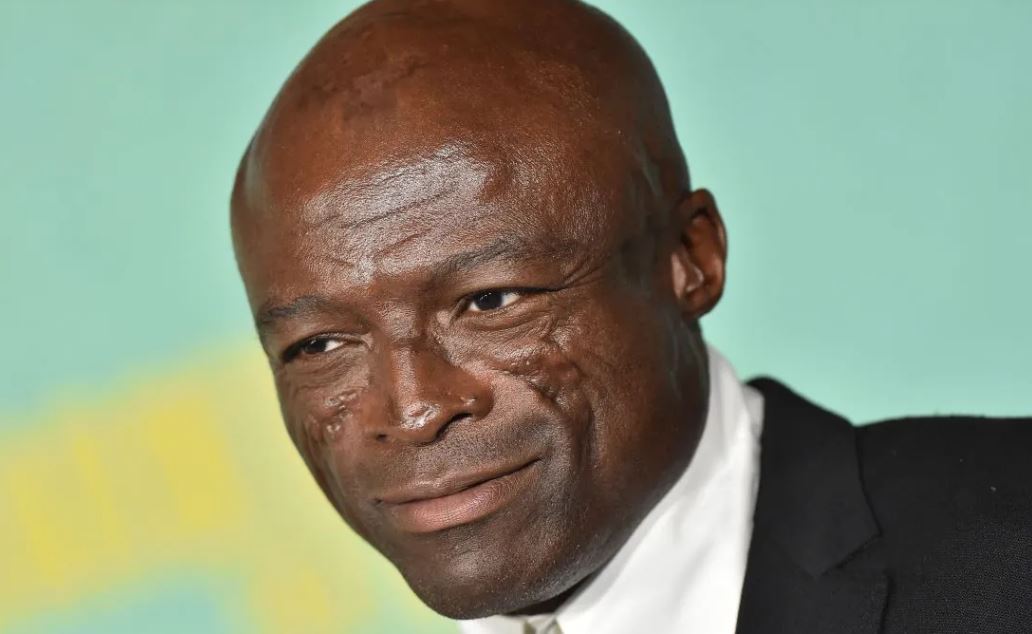 What Happened To Seal’s Face And Head